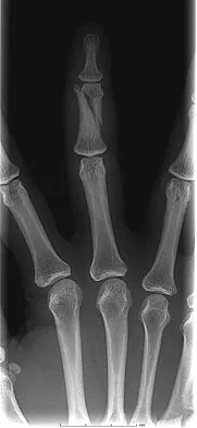 Trauma 2009 Practice Questions: Set 1 (Solved) - Figure 19