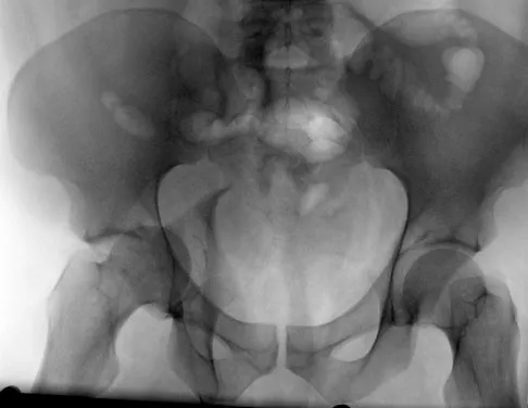 Trauma 2009 Practice Questions: Set 1 (Solved) - Figure 2