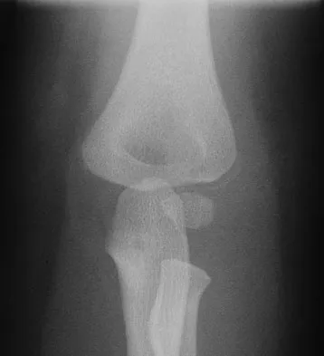 Trauma 2009 Practice Questions: Set 1 (Solved) - Figure 22