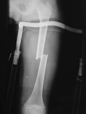 Trauma 2009 Practice Questions: Set 1 (Solved) - Figure 29