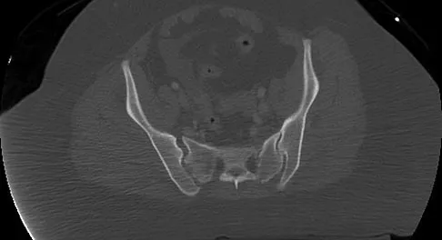 Trauma 2009 Practice Questions: Set 1 (Solved) - Figure 31