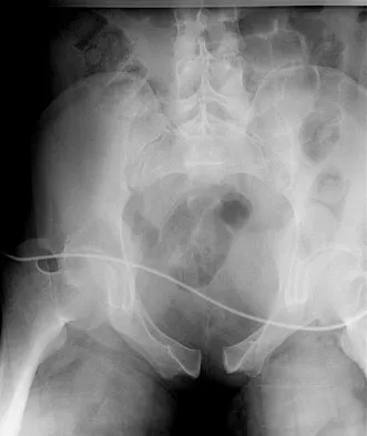 Trauma 2009 Practice Questions: Set 1 (Solved) - Figure 36