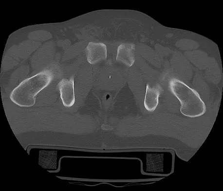 Trauma 2009 Practice Questions: Set 1 (Solved) - Figure 38