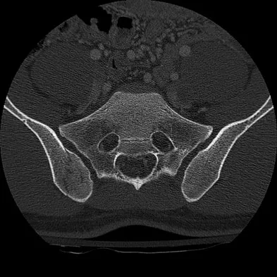 Trauma 2009 Practice Questions: Set 1 (Solved) - Figure 40