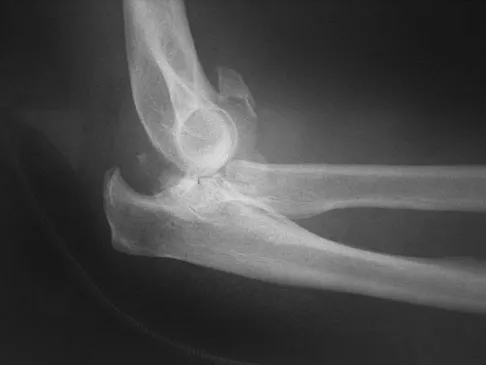 Trauma 2009 Practice Questions: Set 1 (Solved) - Figure 6