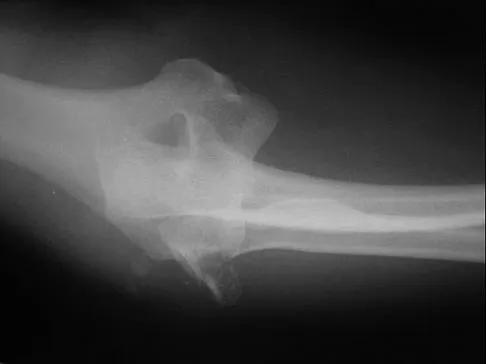 Trauma 2009 Practice Questions: Set 1 (Solved) - Figure 7