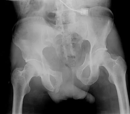 Trauma Board Review 2009: High-Yield MCQs (Set 2) - Figure 1