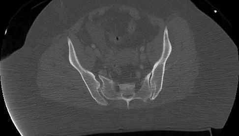 Trauma Board Review 2009: High-Yield MCQs (Set 2) - Figure 10