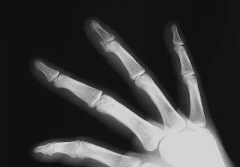 Trauma Board Review 2009: High-Yield MCQs (Set 2) - Figure 12