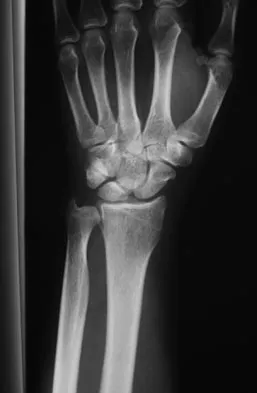 Trauma Board Review 2009: High-Yield MCQs (Set 2) - Figure 13