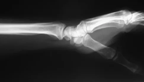 Trauma Board Review 2009: High-Yield MCQs (Set 2) - Figure 15