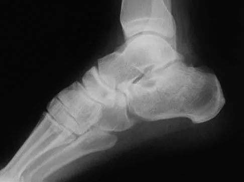 Trauma Board Review 2009: High-Yield MCQs (Set 2) - Figure 22