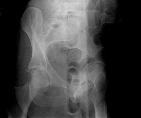 Trauma Board Review 2009: High-Yield MCQs (Set 2) - Figure 35