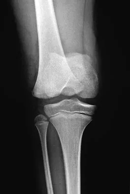 Trauma Board Review 2009: High-Yield MCQs (Set 2) - Figure 39
