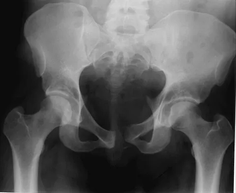 Trauma Board Review 2009: High-Yield MCQs (Set 2) - Figure 6