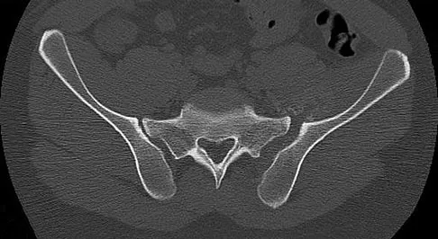 Trauma Board Review 2009: High-Yield MCQs (Set 2) - Figure 8