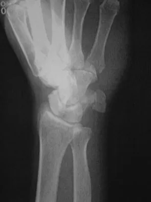 Trauma 2009 Practice Questions: Set 3 (Solved) - Figure 1