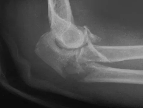 Trauma 2009 Practice Questions: Set 3 (Solved) - Figure 14