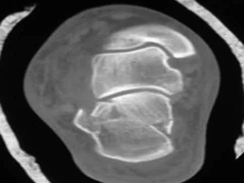 Trauma 2009 Practice Questions: Set 3 (Solved) - Figure 16