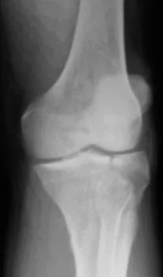 Trauma 2009 Practice Questions: Set 3 (Solved) - Figure 19
