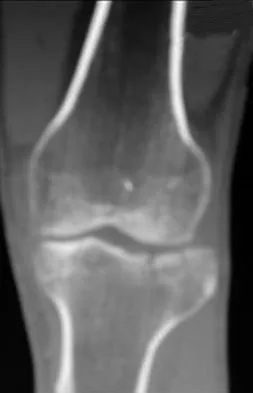 Trauma 2009 Practice Questions: Set 3 (Solved) - Figure 20
