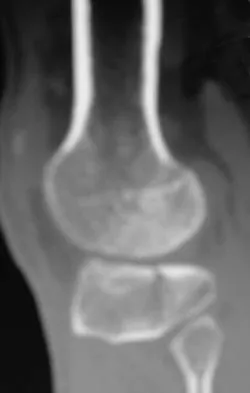 Trauma 2009 Practice Questions: Set 3 (Solved) - Figure 21