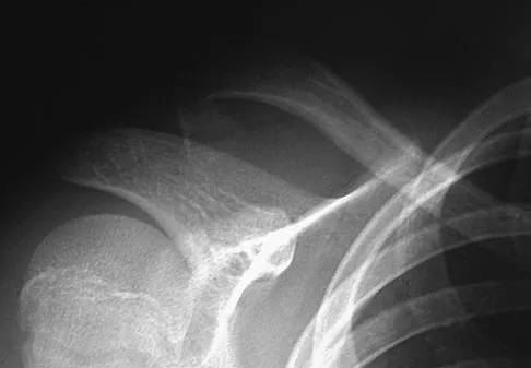 Trauma 2009 Practice Questions: Set 3 (Solved) - Figure 22