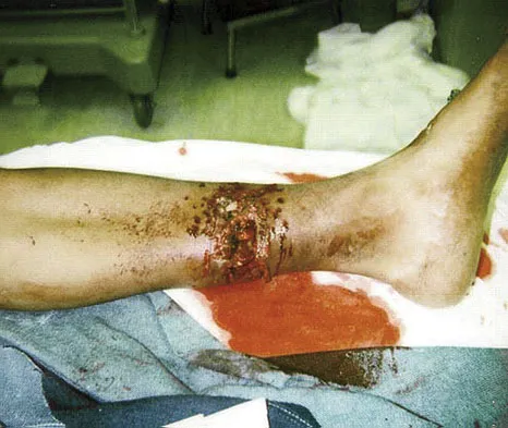 Trauma 2009 Practice Questions: Set 3 (Solved) - Figure 23