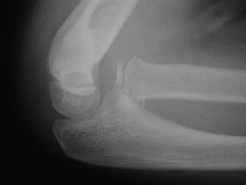 Trauma 2009 Practice Questions: Set 3 (Solved) - Figure 6