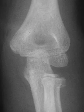 Trauma 2009 Practice Questions: Set 3 (Solved) - Figure 7