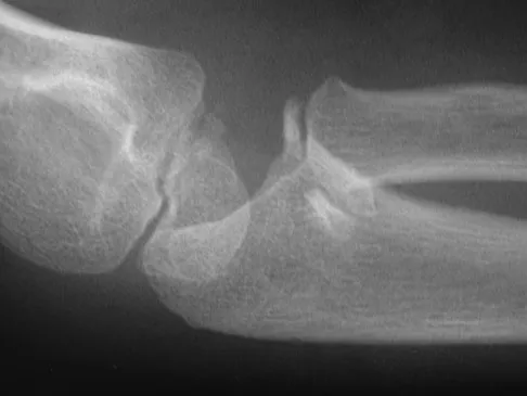 Trauma 2009 Practice Questions: Set 3 (Solved) - Figure 8