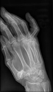 Trauma Board Review 2009: High-Yield MCQs (Set 4) - Figure 1