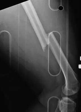 Trauma Board Review 2009: High-Yield MCQs (Set 4) - Figure 11