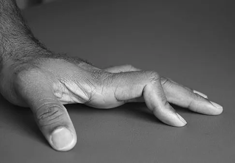 Trauma Board Review 2009: High-Yield MCQs (Set 4) - Figure 13