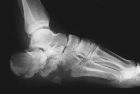 Trauma Board Review 2009: High-Yield MCQs (Set 4) - Figure 14