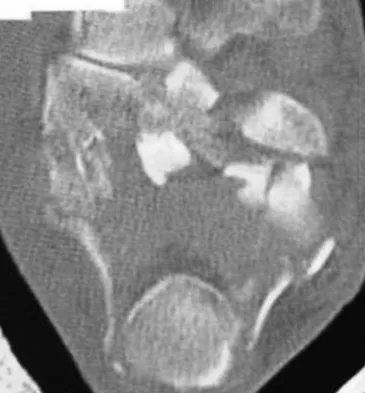 Trauma Board Review 2009: High-Yield MCQs (Set 4) - Figure 15