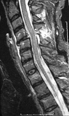 Trauma Board Review 2009: High-Yield MCQs (Set 4) - Figure 17