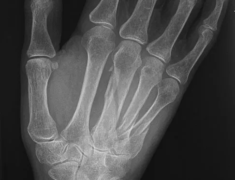 Trauma Board Review 2009: High-Yield MCQs (Set 4) - Figure 19