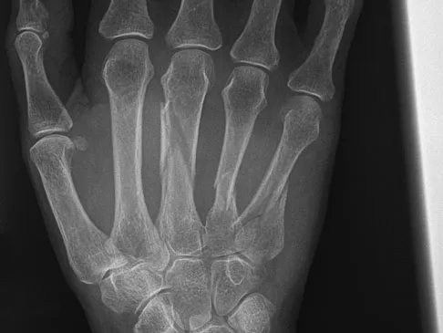 Trauma Board Review 2009: High-Yield MCQs (Set 4) - Figure 20