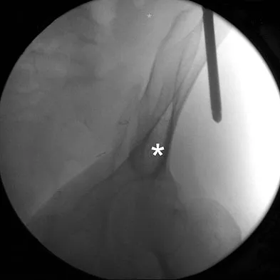 Trauma Board Review 2009: High-Yield MCQs (Set 4) - Figure 24