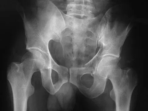 Trauma Board Review 2009: High-Yield MCQs (Set 4) - Figure 27