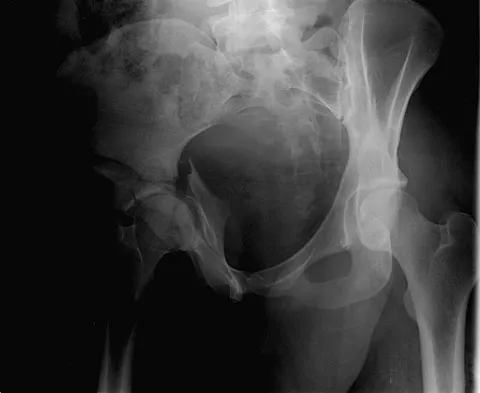 Trauma Board Review 2009: High-Yield MCQs (Set 4) - Figure 7