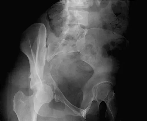 Trauma Board Review 2009: High-Yield MCQs (Set 4) - Figure 8