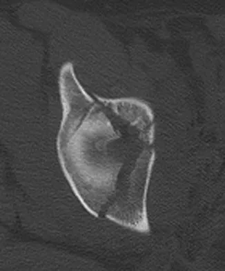 Trauma Board Review 2009: High-Yield MCQs (Set 4) - Figure 9