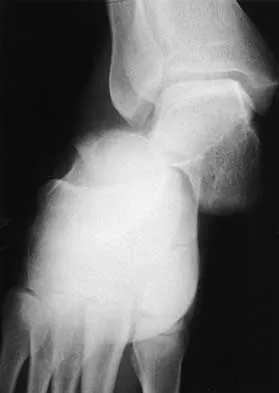 Orthopedic Trauma 2026 MCQs (Part 1): Fracture Management & Emergency Orthopedics | Board Review