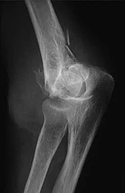 Trauma 2026 MCQs: Board Review Questions & Answers (Part 1) - Figure 109