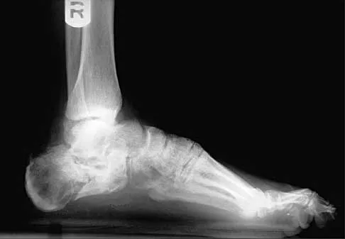 Trauma 2026 MCQs: Board Review Questions & Answers (Part 1) - Figure 115