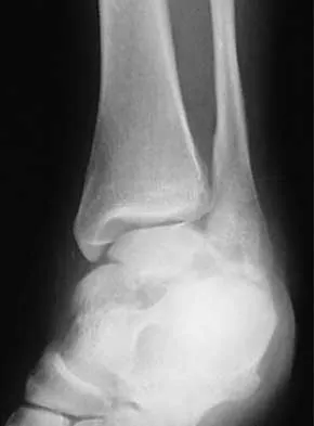 Trauma 2026 MCQs: Board Review Questions & Answers (Part 1) - Figure 13