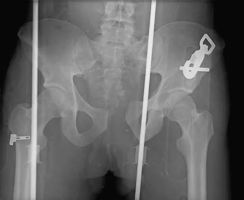 Trauma 2026 MCQs: Board Review Questions & Answers (Part 1) - Figure 131