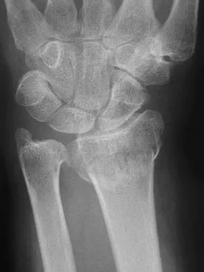 Trauma 2026 MCQs: Board Review Questions & Answers (Part 1) - Figure 139